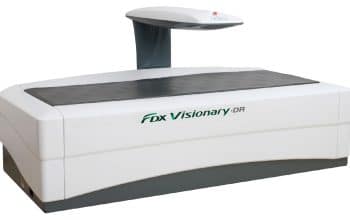 Csontsűrűség vizsgálati gép