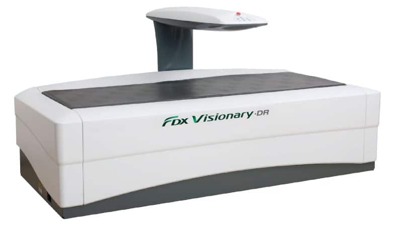 Csontsűrűség vizsgálati gép